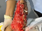 Korban Tabrak Lari membutuhkan uluran bantuan/Ist.