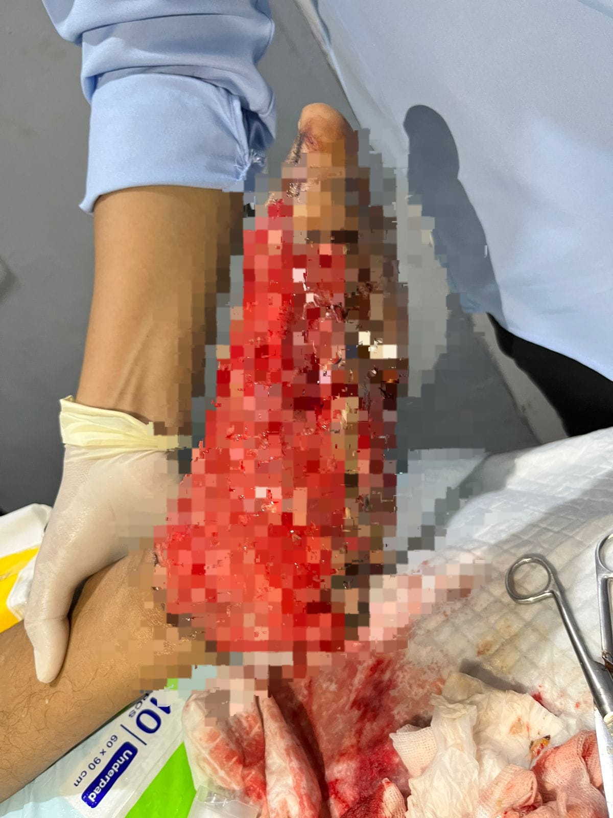 Korban Tabrak Lari membutuhkan uluran bantuan/Ist.